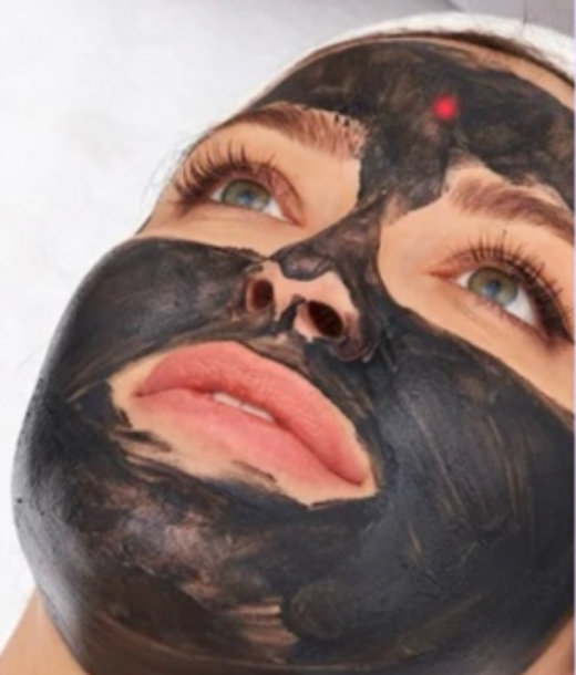 Carbon Peel