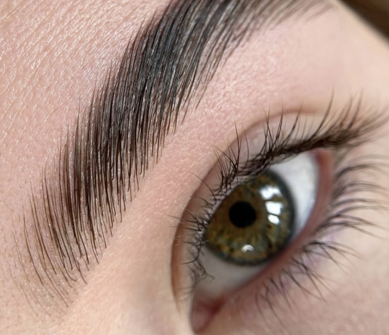 Brow Lift