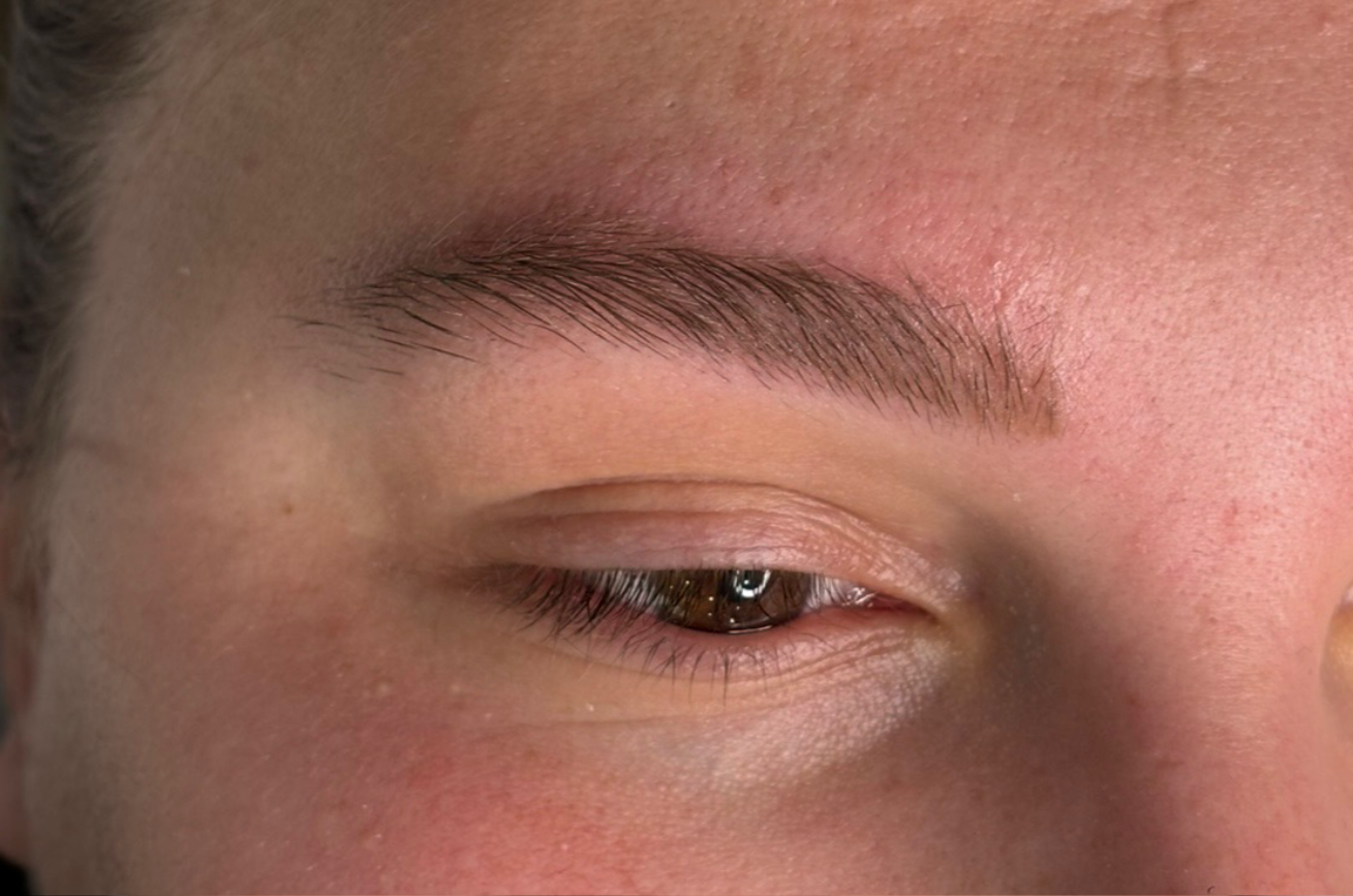 fotografija 4